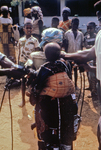 Nigerian Children Getting Vaccinated for Measles and Smallpox During the Biafran War